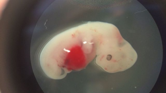 Embrion quimerico 