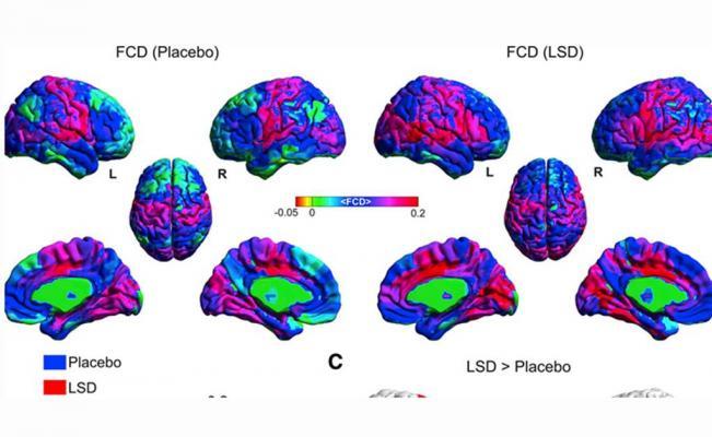 Efectos del LSD en el cerbro