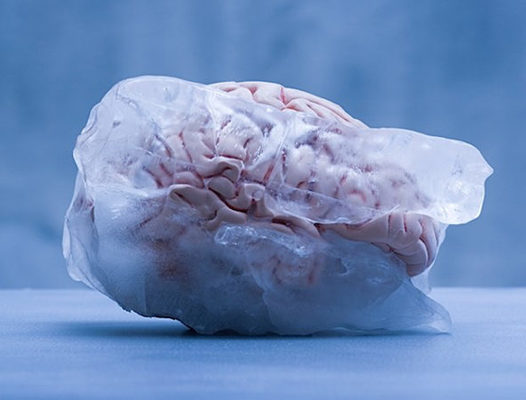 cerebro congelado