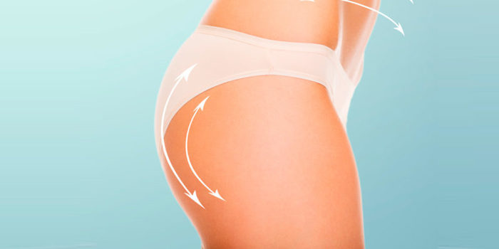 gluteos e1493558860650 Merca2.es