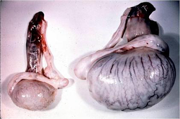 atrofia testicular