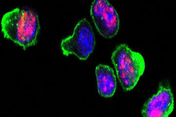 t cells ms neurosciencenews Merca2.es