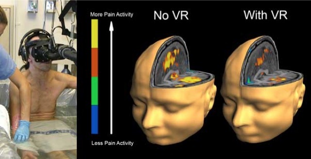 fMRI Heads8 600 Merca2.es