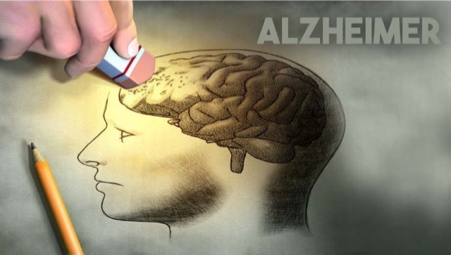 alzheimer ilustracao Merca2.es