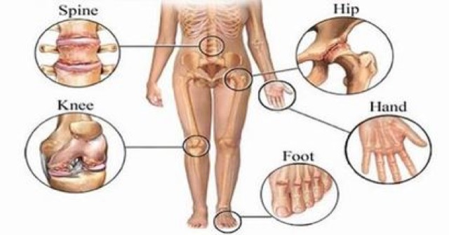 center for arthritis and osteoporosis aids uk gadgets aj Merca2.es