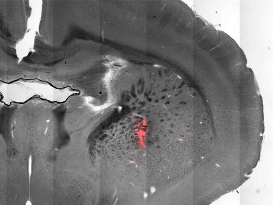 striatum magnetic stimulation neurosciencenews Merca2.es