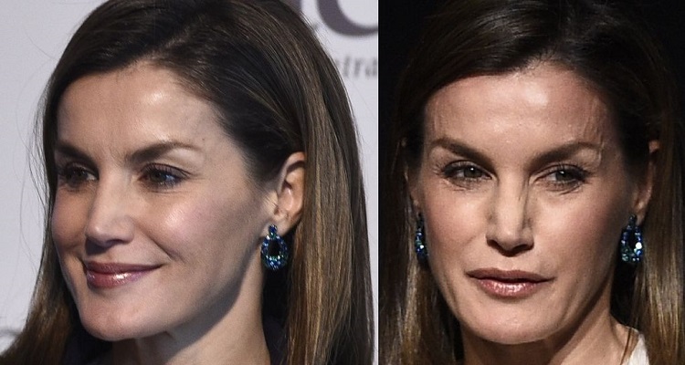 Letizia-botox.jpg