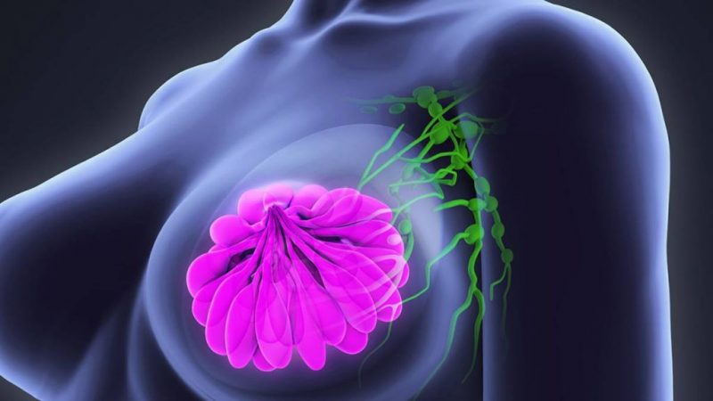 pruebas para detectar el cáncer en la mama