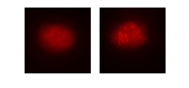 2019 09 19 A la izda célula de sangre de paciente afectado. A la dcha corregida con el CRISPRCas9. Se observa la reparación la función de la ruta de la anemia de Fanconi 1 Merca2.es