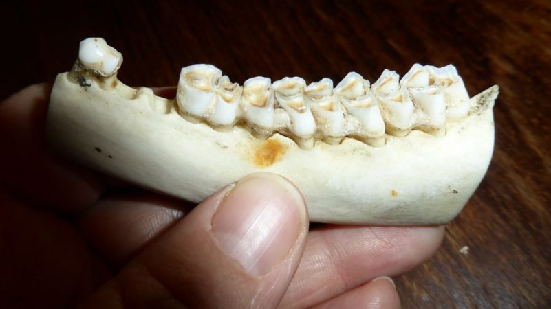 caída de dientes por estrés