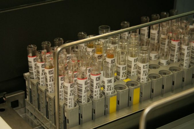 Así es como se pueden prevenir las infecciones de orina 1 Merca2.es infecciones de orina