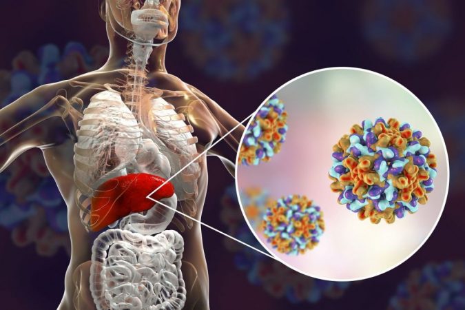 Virus de la hepatitis B y C cáncer