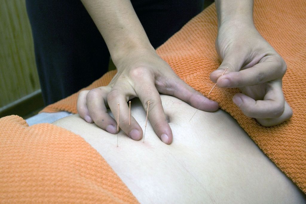 acupuntura estómago