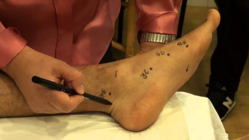 pie médico