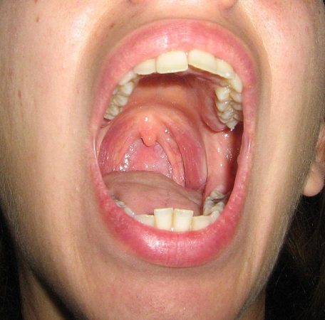 amigdalas órganos que no sirven