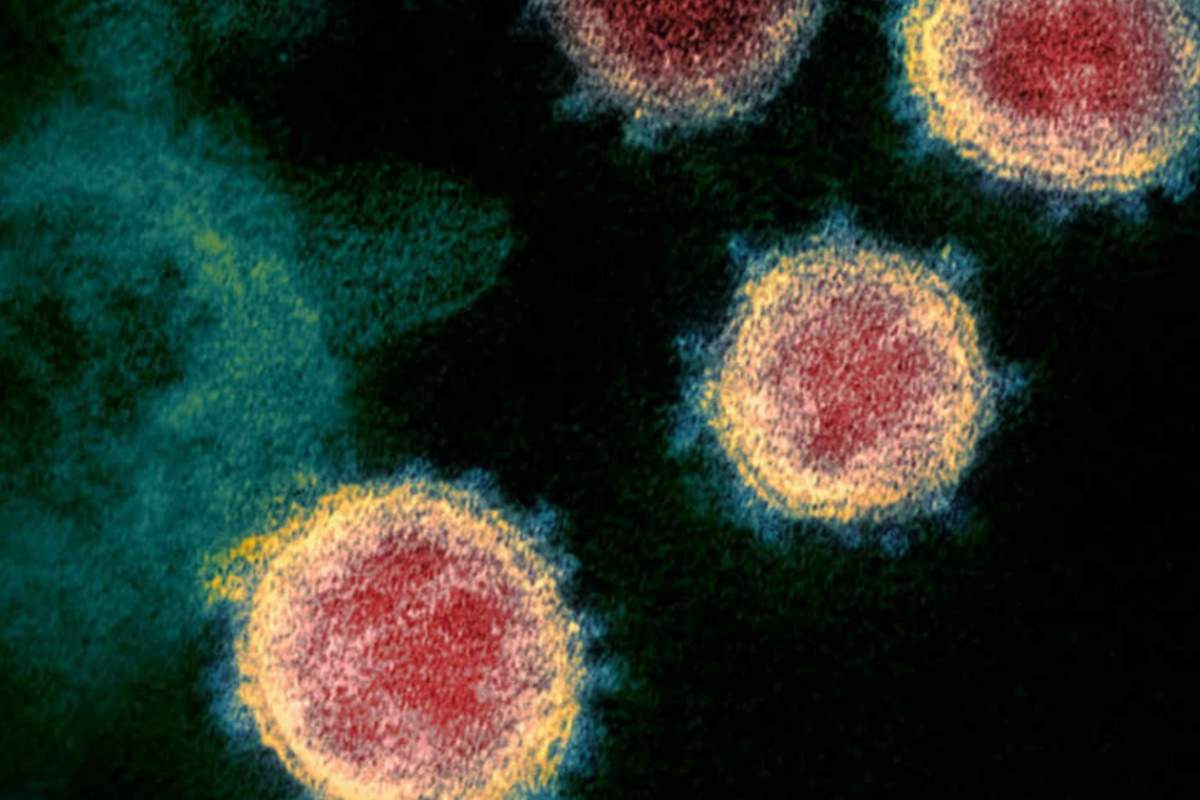 ¿Tengo coronavirus? Síntomas desconocidos que tiene mucha gente