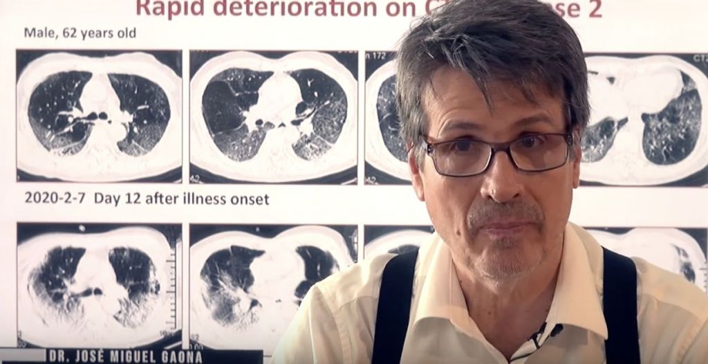 Doctor Gaona expone los sorprendentes efectos secundarios del coronavirus