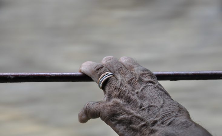 arrugas piel manos