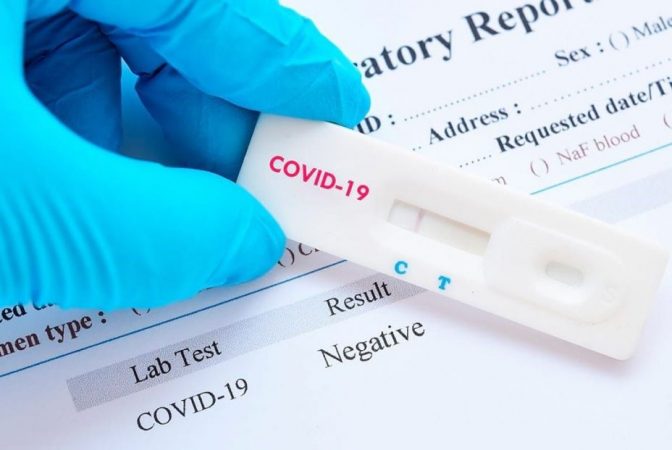 Laboratorios y clínicas: Claves para que te hagas la prueba del SARS-CoV-2 