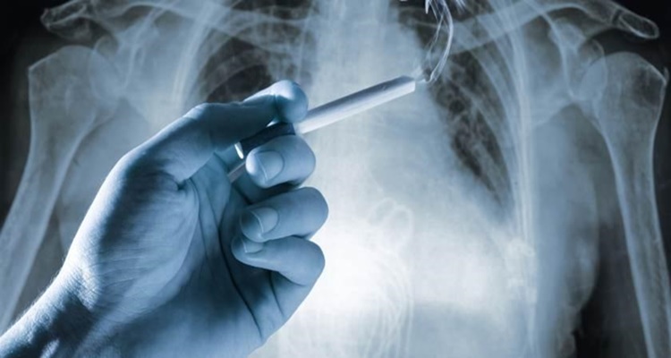 Función pulmonar cigarrillo