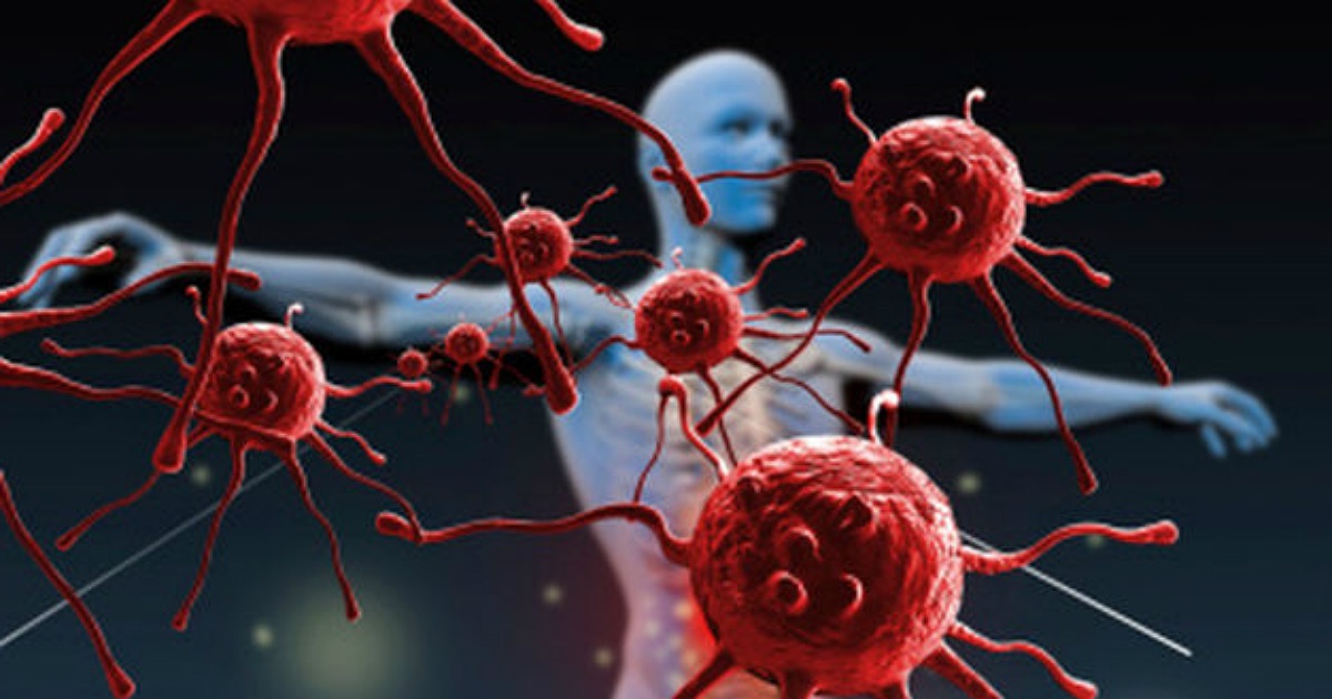 Cáncer: los cinco más mortales que puedes padecer