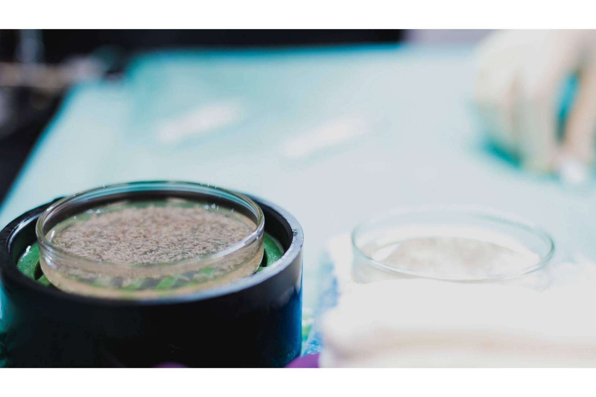 ¿En qué consisten los populares microinjertos de barba y cejas?, por la Clínica Adcure
