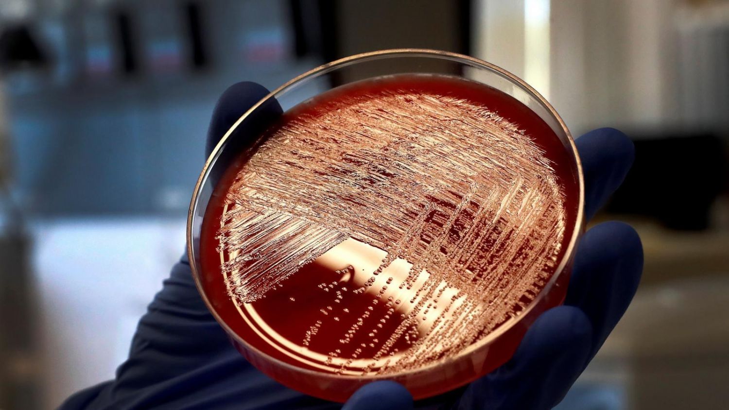 La listeria, una bacteria silenciosa que aumenta su presencia en verano