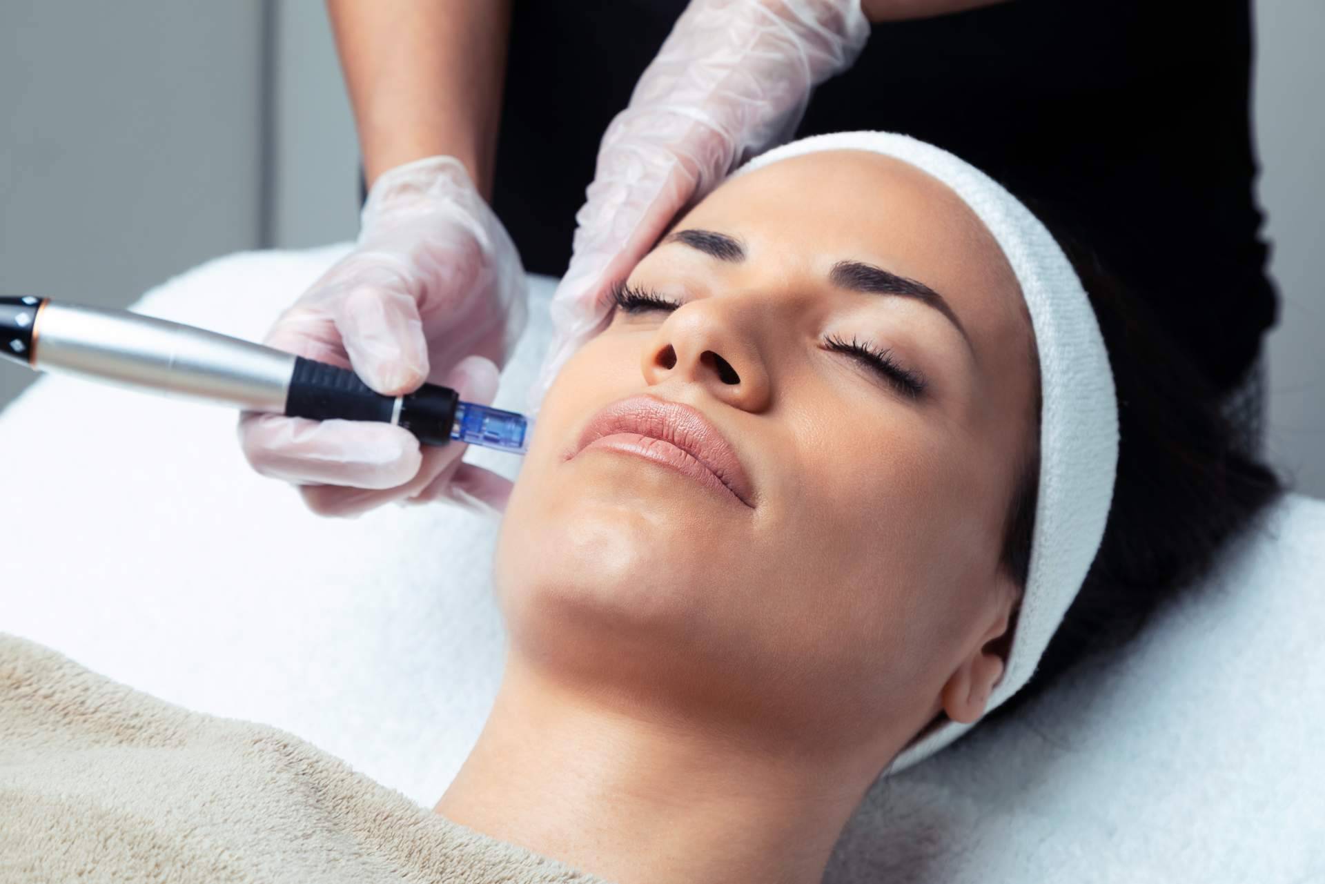 Mesoterapia facial de VG Virginia Gómez