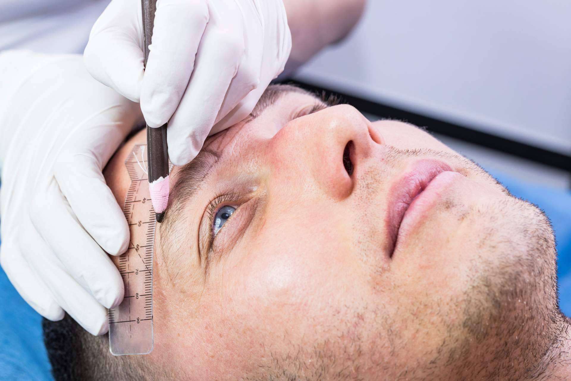 Clínicas Dr. Pelo realiza el trasplante capilar en las cejas