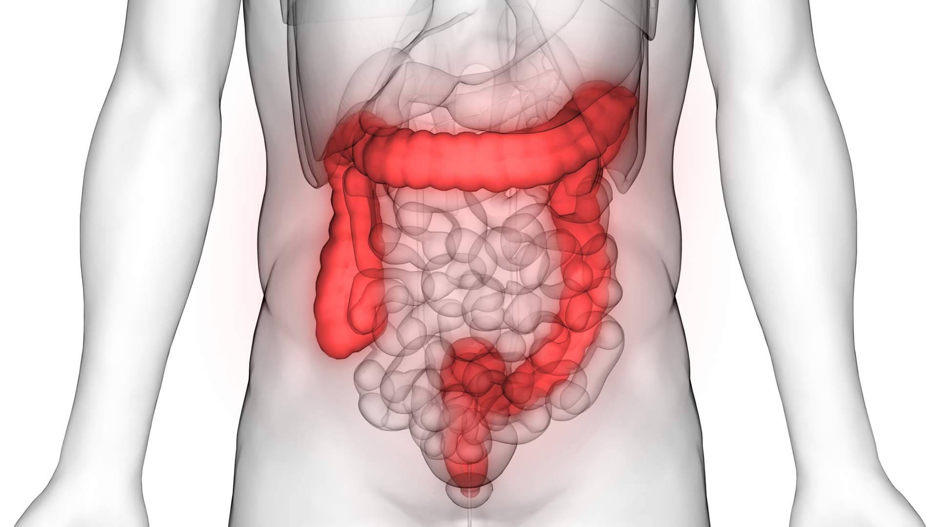 El Dr. Fernando Ruger Viarengo aporta las claves para un diagnóstico adecuado y en su caso un tratamiento de colon irritable