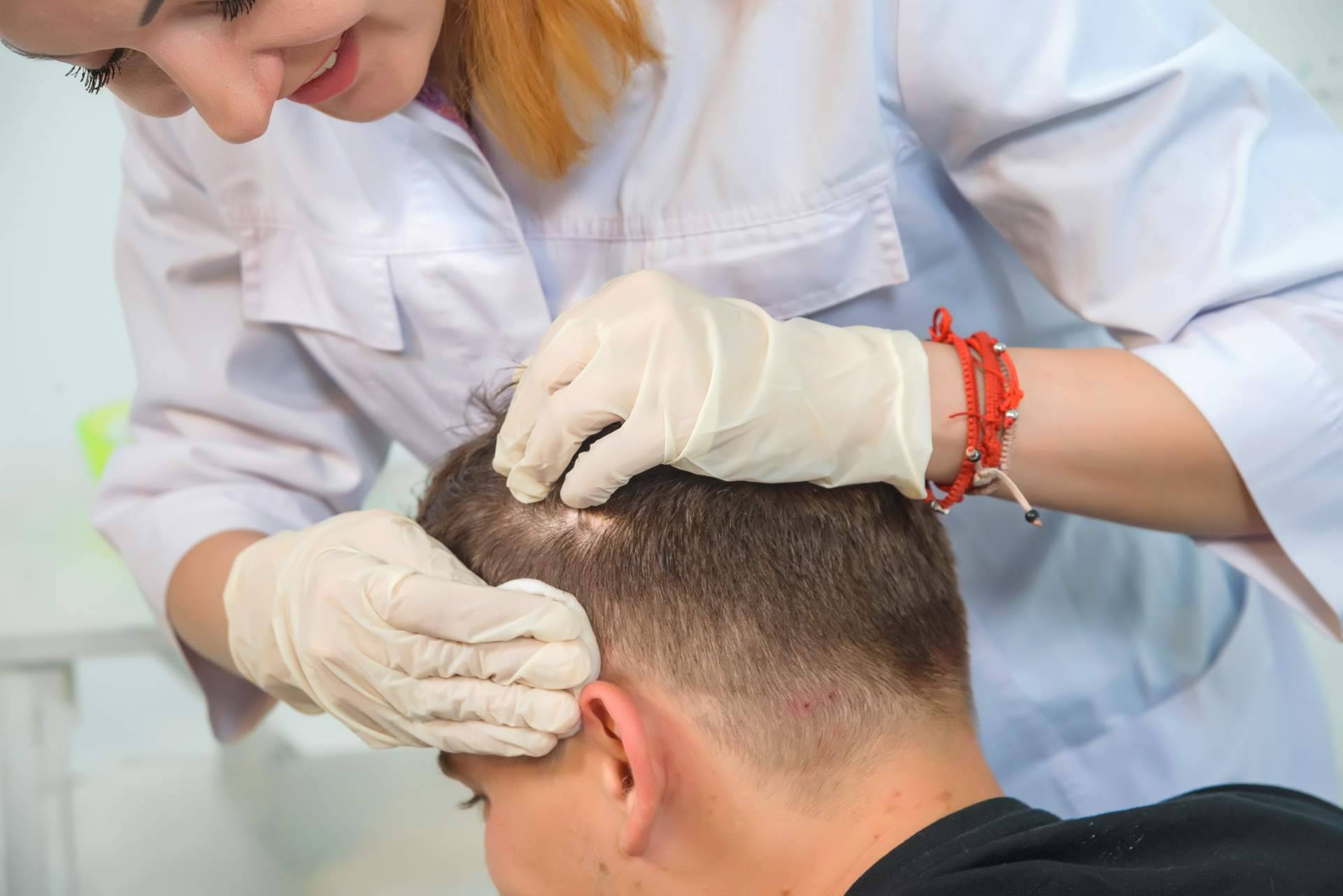 ¿Láser capilar o mesoterapia capilar?