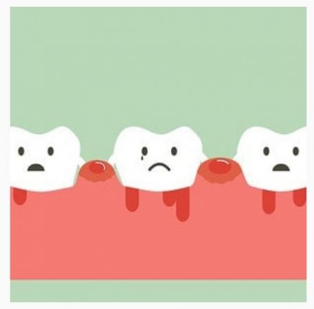 dientes
