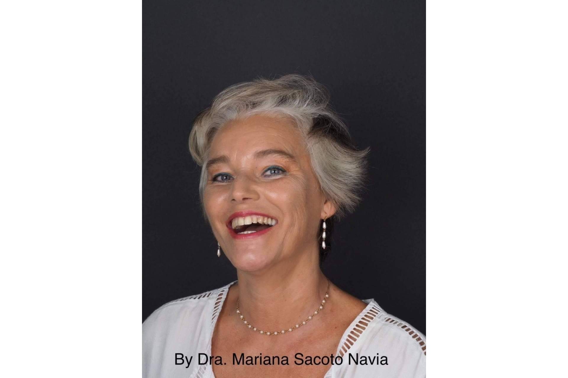 La ortodoncia para diseñar sonrisas, Invisalign®