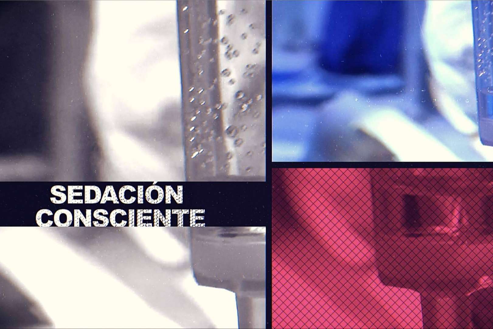 Sedación consciente en la clínica dental Formación en Implantología para pacientes con fobia al dentista