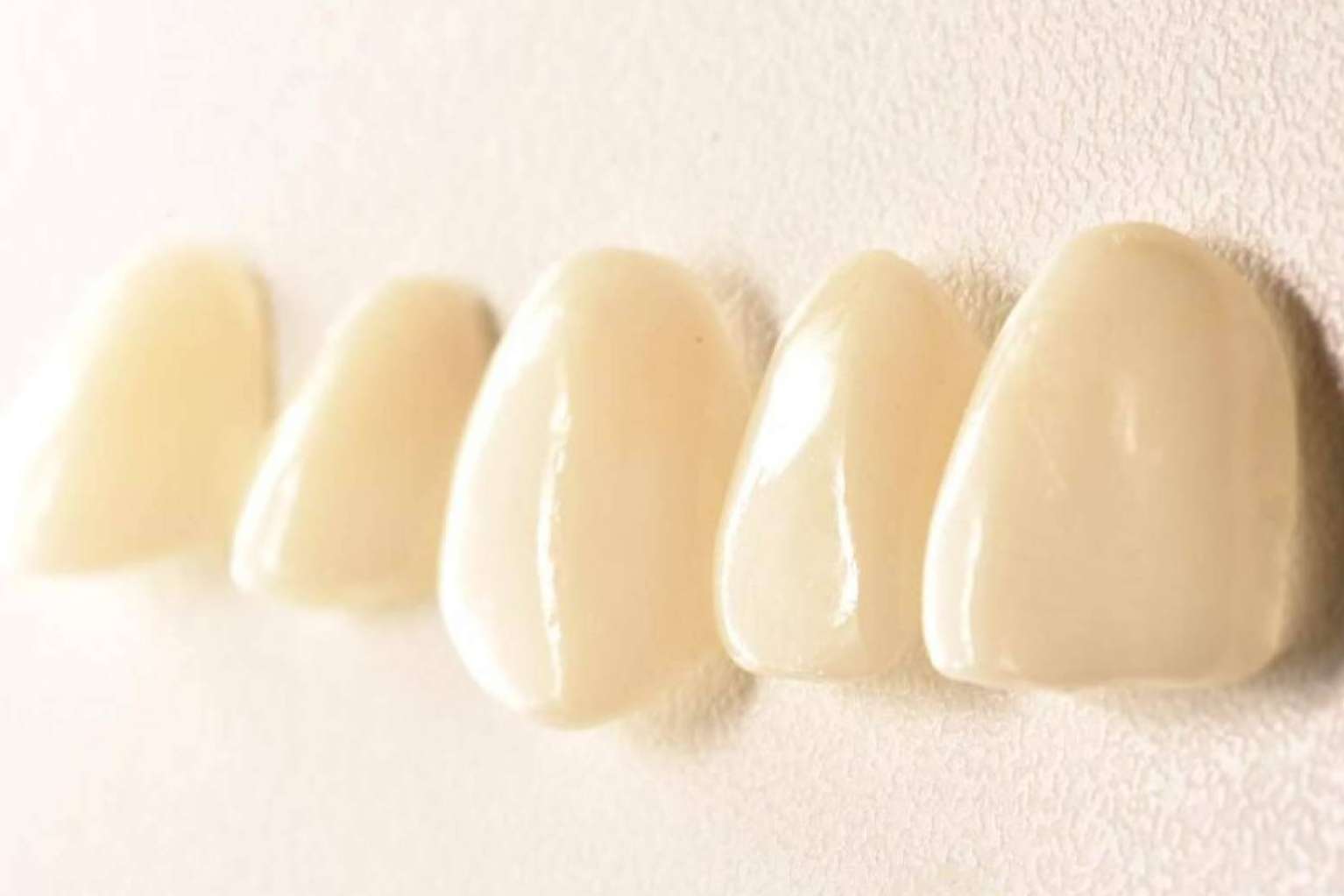 Las ventajas de los tratamientos de estética dental según Implant Clinics
