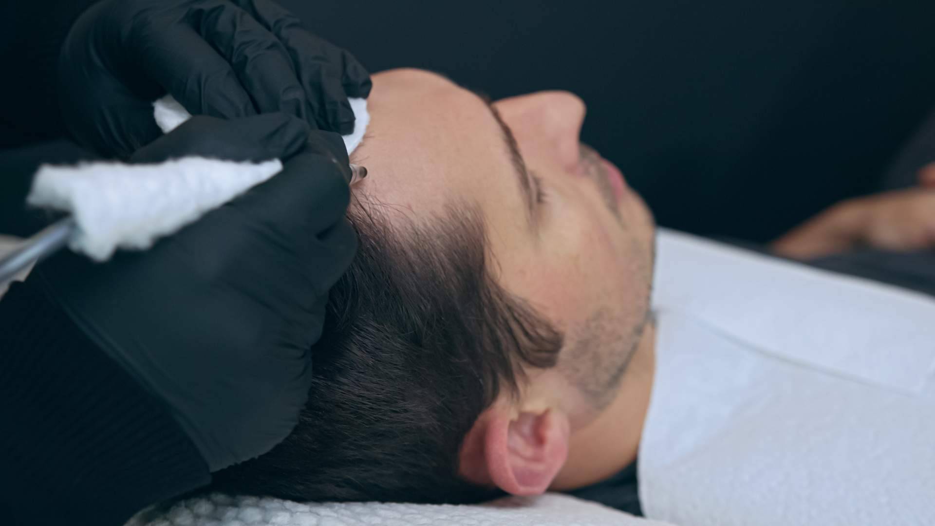 Las Clínicas Dr. Pelo brindan tratamientos de micropigmentación con efecto de redensificación