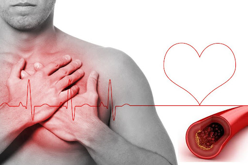 Colesterol: cómo saber si lo tienes alto sin ir al médico