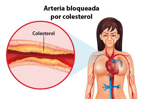 El colesterol