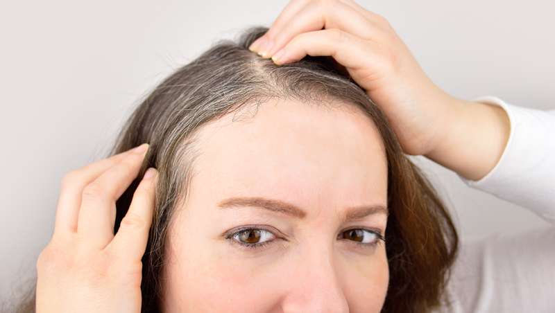 ¿Por qué aparecen las canas?