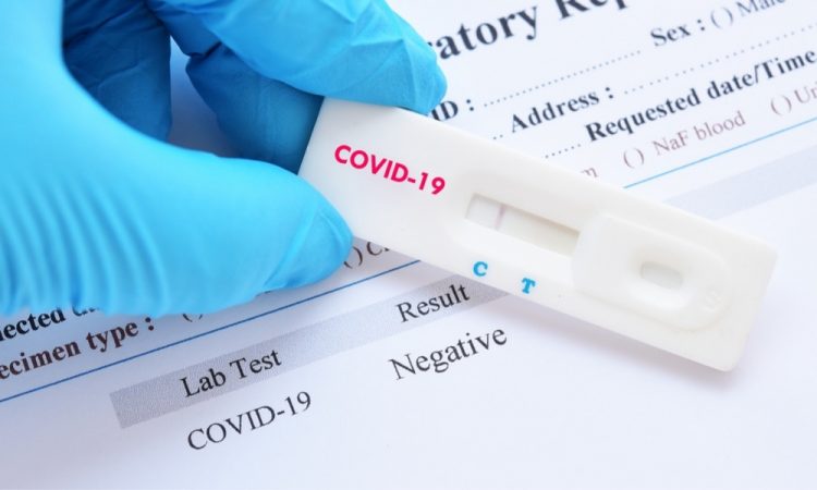 Cuándo hay que repetir los test de antígenos si son negativos 2 Moncloa test antígenos