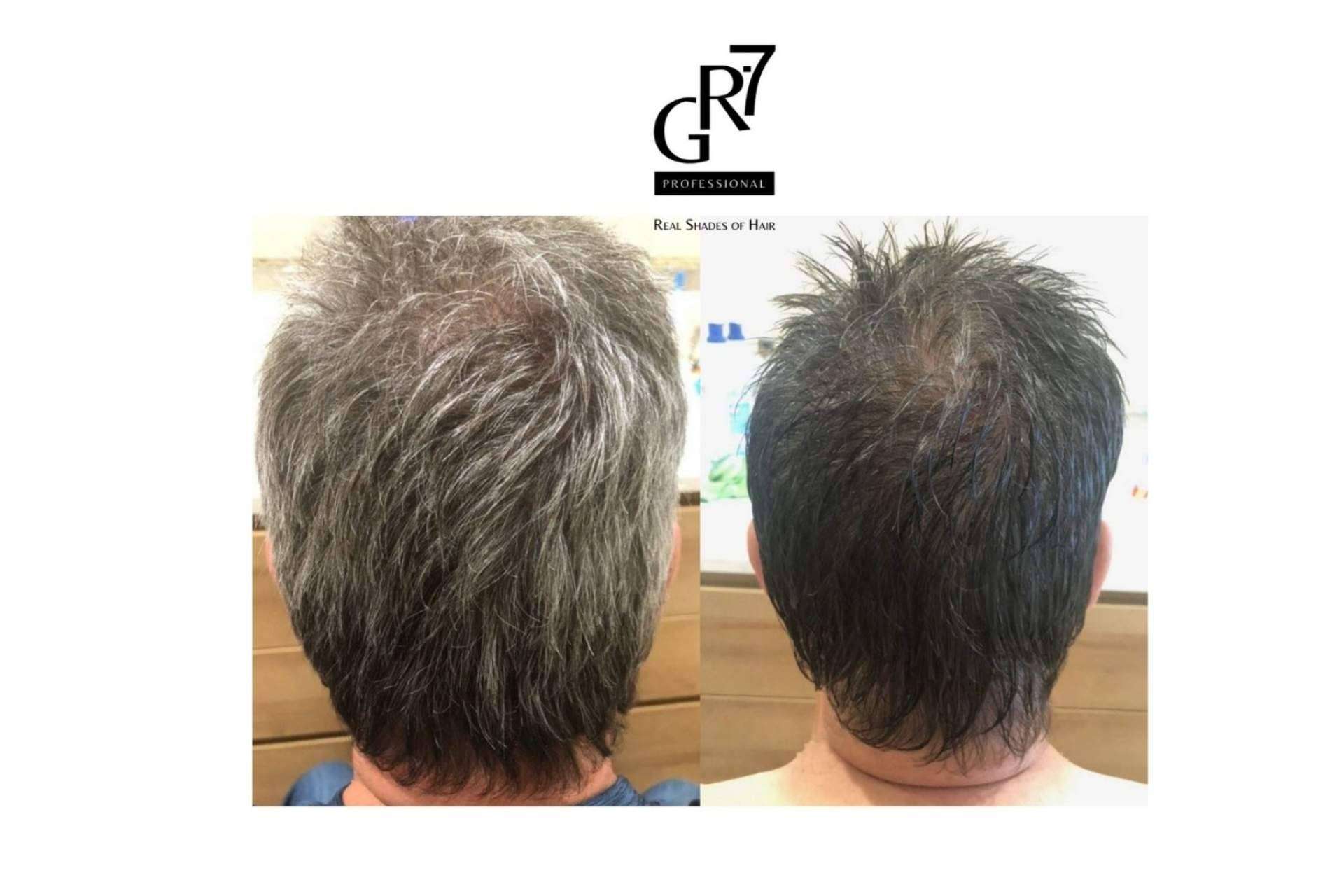 El tratamiento anticanas que restaura el tono natural, GR-7 Professional