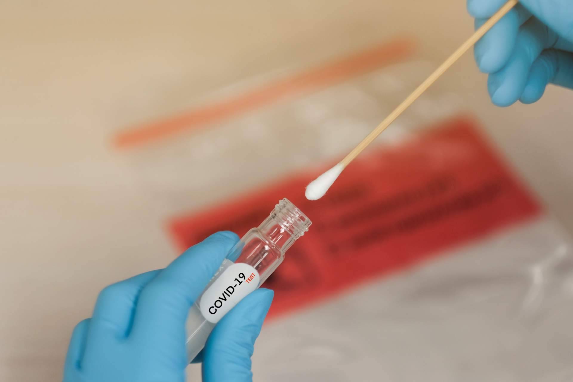 Centro Médico Bravo explica por qué es importante realizarse un test COVID aunque se tenga la pauta de vacunación completa