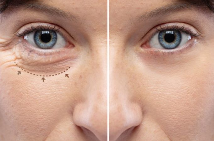 cirugía estética