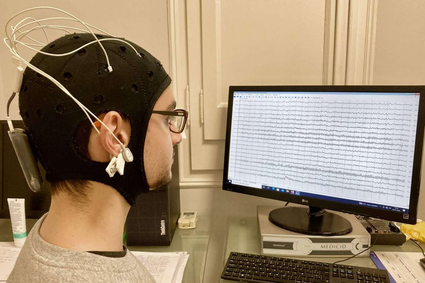 Los tratamientos de neuromodulación ayudan a la recuperación tras sufrir un ictus