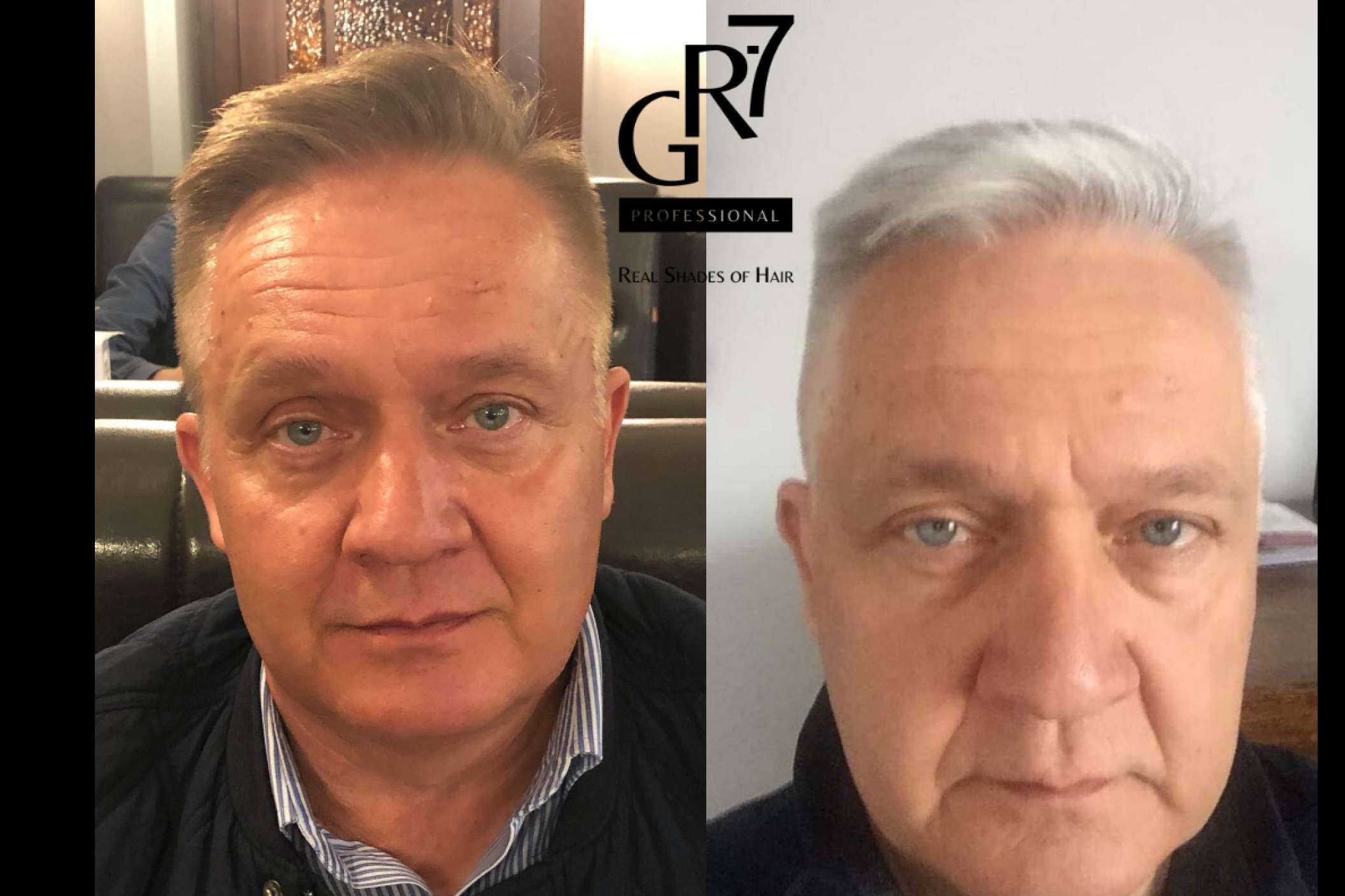 La loción GR-7 Professional revierte la aparición de canas y devuelve el color natural