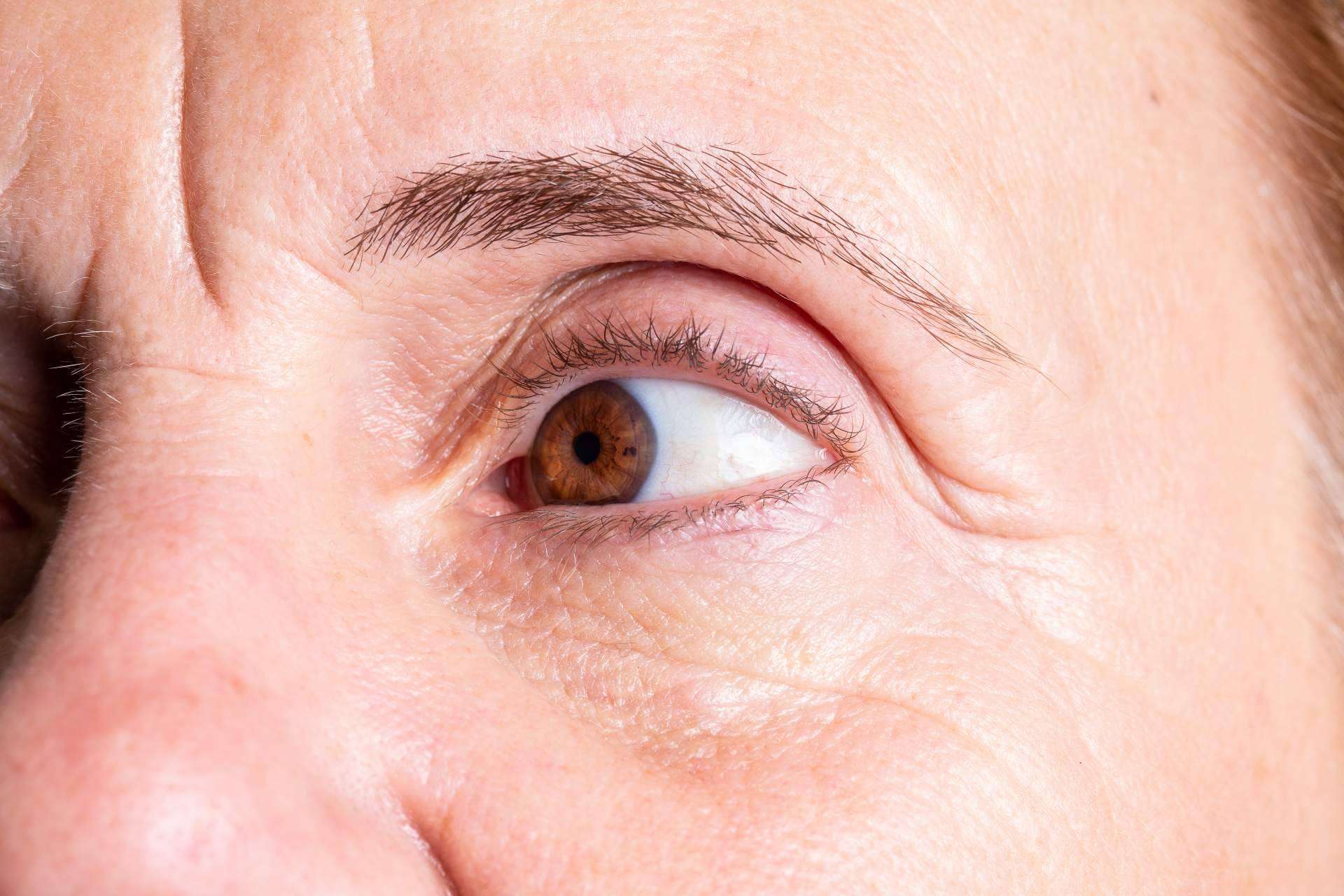 Especialista en medicina estética de tratamientos de ojeras, Dr. Carlos Zito