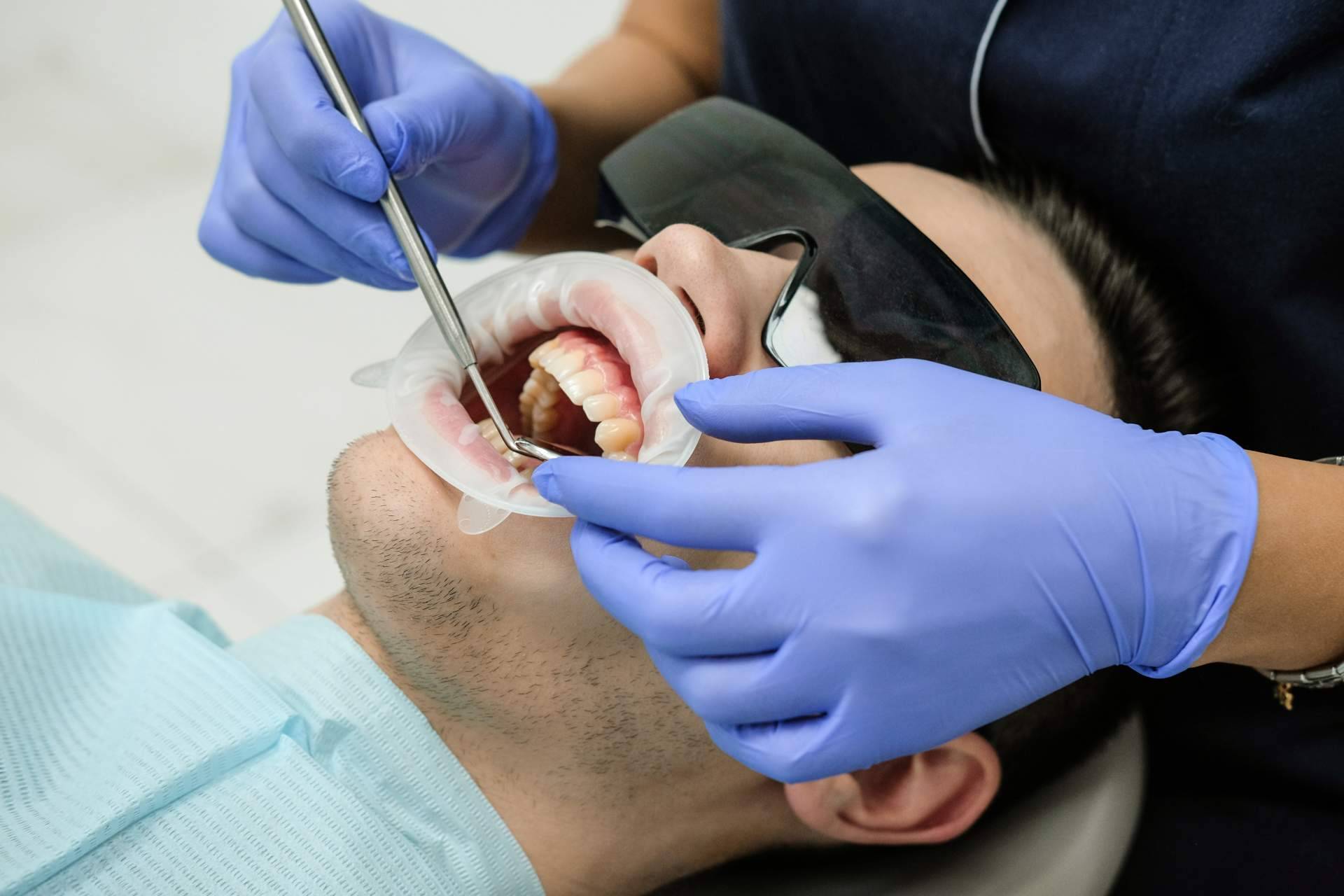 Implant Clinics resuelve las dudas sobre qué es y en qué consiste una endodoncia