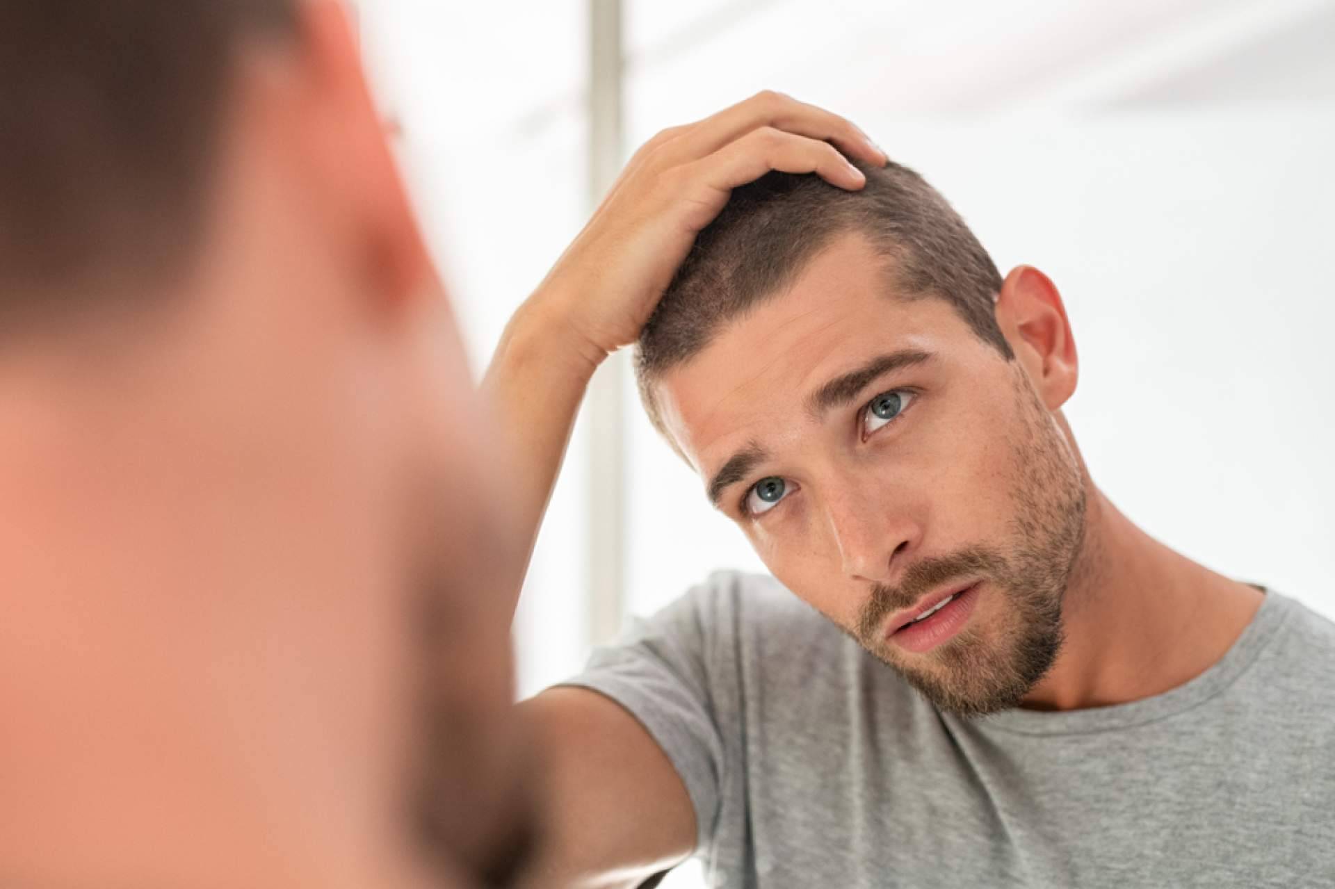 Saw Palmetto ofrece Xpecia Tablet, una alternativa para combatir la alopecia