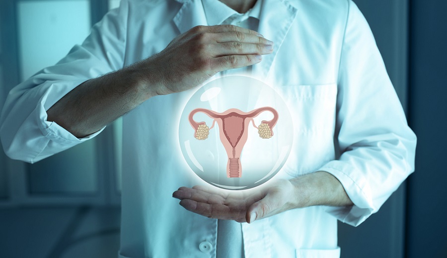 8 de mayo, Día Mundial del Cáncer de Ovario – Cerca del 10% de los canceres de ovario son hereditarios