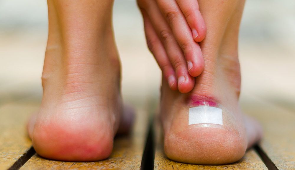 El secreto para que unas sandalias nuevas no te rocen